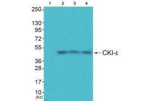 Western blot analysis of extracts from HuvEc cells (Lane 2), JK cells (Lane 3) and cos-7 cells (Lane 4), using CKI-ε antiobdy antiobdy. (CK1 epsilon 抗体)