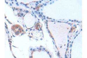 Detection of GbL in Human Thyroid Tissue using Polyclonal Antibody to G Protein Beta Subunit Like Protein (GbL) (GNB1L 抗体  (AA 69-247))