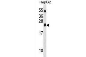Western Blotting (WB) image for anti-Dehydrogenase/reductase (SDR Family) Member 4 Like 2 (DHRS4L2) antibody (ABIN3000211) (DHRS4L2 抗体)