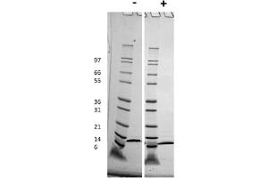 SDS-PAGE of Human ITAC (CXCL11) Recombinant Protein SDS-PAGE of Human ITAC (CXCL11) Recombinant Protein. (CXCL11 蛋白)