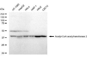 Western blotting analysis using Acetyl-CoA acetyltransferase 2 antibody (ABIN7797440).