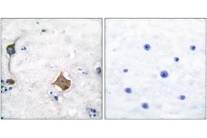 Immunohistochemistry analysis of paraffin-embedded human brain tissue, using Synaptophysin Antibody. (Synaptophysin 抗体  (AA 101-150))