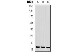 Western blot analysis of CKLF1 expression in Jurkat (A), K562 (B), NIH3T3 (C) whole cell lysates. (CKLF 抗体  (C-Term))