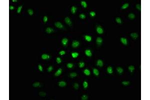 Immunofluorescence staining of Hela cells(treated with 50 mM Calyculin A for 30 min) with ABIN7127689 at 1:100,counter-stained with DAPI. (Recombinant EIF2AK2 抗体  (pThr446))