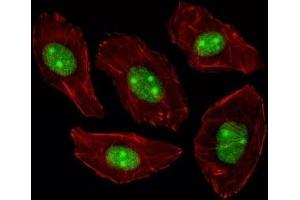 Fluorescent image of A549 cells stained with NPM1 antibody. (NPM1 抗体  (AA 198-226))