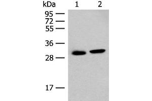 Western blot analysis of Mouse kidney tissue and Human kidney tissue lysates using GLYAT Polyclonal Antibody at dilution of 1:300 (GLYAT 抗体)