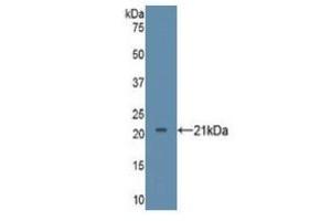 WB of Protein Standard: different control antibodies against Highly purified E. (TNF alpha ELISA 试剂盒)