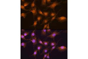 Immunofluorescence analysis of C6 cells using SKP2 Rabbit pAb (ABIN6134430, ABIN6147822, ABIN6147824 and ABIN6223665) at dilution of 1:100. (SKP2 抗体  (AA 1-100))