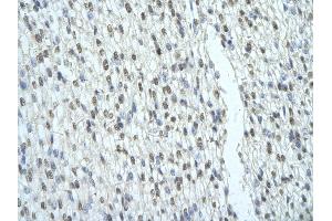 Rabbit Anti-SFRS2B antibody   Paraffin Embedded Tissue: Human Heart cell Cellular Data: cardiac cell of renal tubule Antibody Concentration: 4. (SFRS2B 抗体  (Middle Region))