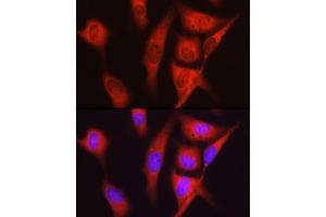 Immunofluorescence analysis of U2OS cells using S6 Ribosomal Protein (RPS6) Rabbit pAb (ABIN6133901, ABIN6147227, ABIN6147228 and ABIN6221687) at dilution of 1:100 (40x lens). (RPS6 抗体  (AA 1-100))