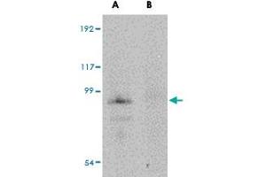 Western blot analysis of JPH4 in mouse brain tissue lysate with JPH4 polyclonal antibody  at 1 ug/mL in (A) the absence and (B) the presence of blocking peptide. (Junctophilin 4 抗体  (Internal Region))