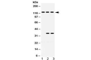 Western blot testing of 1) rat brain, 2) human HeLa and 3) human Jurkat lysate with ARHGEF1 antibody at 0. (ARHGEF1 抗体  (AA 41-71))