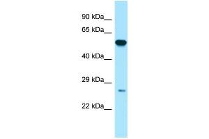Host:  Rabbit  Target Name:  GSTP1  Sample Type:  Placenta lysates  Antibody Dilution:  1. (GSTP1 抗体  (N-Term))
