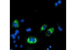 Anti-AGPAT5 mouse monoclonal antibody (ABIN2455450) immunofluorescent staining of COS7 cells transiently transfected by pCMV6-ENTRY AGPAT5 (RC210280). (AGPAT5 抗体)