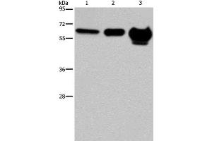 Western Blot analysis of 823 cell, Mouse brain and Human fetal brain tissue using MMP20 Polyclonal Antibody at dilution of 1:400 (MMP20 抗体)