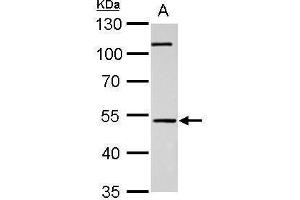 Western Blotting (WB) image for anti-Cannabinoid Receptor 1 (CNR1) (C-Term) antibody (ABIN2854658)