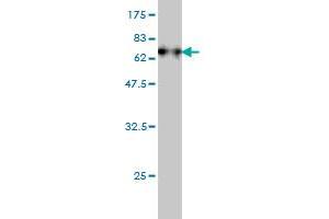 Western Blot detection against Immunogen (74. (Fatty Acid Synthase 抗体  (AA 1-439))