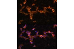 Immunofluorescence (IF) image for anti-Platelet Derived Growth Factor Receptor beta (PDGFRB) (AA 887-1106) antibody (ABIN3023139)