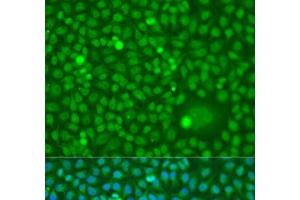 Immunofluorescence analysis of U2OS cells using CDK10 Polyclonal Antibody at dilution of 1:100. (CDK10 抗体)