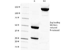 SDS-PAGE Analysis Purified PSA Mouse Monoclonal Antibody (1A7). (Prostate Specific Antigen 抗体)