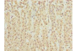 Immunohistochemistry of paraffin-embedded human adrenal gland tissue using ABIN7168896 at dilution of 1:100 (SPTLC2 抗体  (AA 88-562))