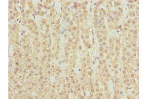 Immunohistochemistry of paraffin-embedded human adrenal gland tissue using ABIN7168896 at dilution of 1:100 (SPTLC2 抗体  (AA 88-562))