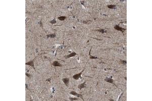 Immunohistochemical staining of human cerebral cortex with SLC35F1 polyclonal antibody  shows strong cytoplasmic positivity in neuronal cells at 1:500-1:1000 dilution. (SLC35F1 抗体)
