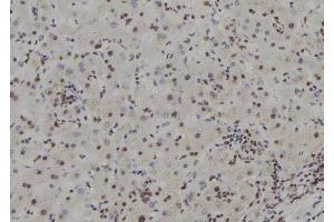 ABIN6277593 at 1/100 staining Human liver tissue by IHC-P. (APRT 抗体  (Internal Region))