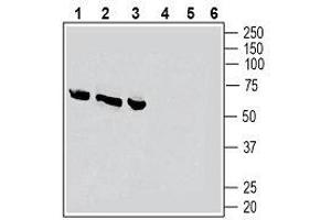 Western blot analysis of rat dorsal root ganglion lysates (lanes 1 and 4), rat lung membranes (lanes 2 and 5) and rat heart membranes (lanes 3 and 6): - 1-3.