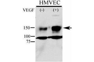 Phospho-KDR antibody used in western blot to detect phosphorylated KDR/FLK1 in HMVEC lysate. (VEGFR2/CD309 抗体  (pTyr996))
