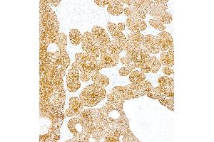 Immunohistochemistry (IHC) image for anti-Keratin 5 (KRT5) (C-Term) antibody (ABIN7795754)