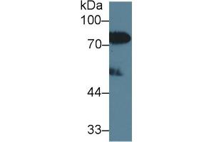 Detection of LBP in Human Serum using Polyclonal Antibody to Lipopolysaccharide Binding Protein (LBP) (LBP 抗体  (AA 27-481))