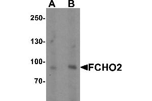 Western blot analysis of FCHO2 in rat heart tissue lysate with FCHO2 antibody at (A) 1 and (B) 2 µg/mL (FCHO2 抗体  (Middle Region))