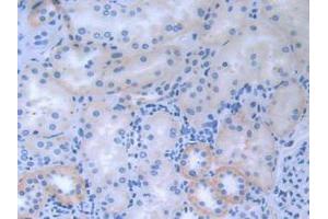 IHC-P analysis of Human Kidney tissue, with DAB staining. (CDCP1 抗体  (AA 689-836))