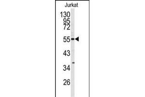 Western blot analysis of CDK8 antibody (N-term) (ABIN391759 and ABIN2841626) in Jurkat cell line lysates (35 μg/lane). (CDK8 抗体  (N-Term))