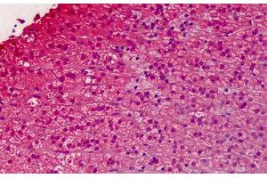 Immunohistochemistry (Formalin-fixed Paraffin-embedded Sections) (IHC (fp)) image for anti-Guanine Nucleotide Binding Protein (G Protein), alpha Inhibiting Activity Polypeptide 1 (GNAI1) (AA 1-355) antibody (ABIN574258)