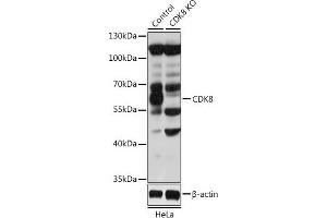 Western blot analysis of extracts from normal (control) and CDK8 knockout (KO) HeLa cells, using CDK8 antibody (ABIN6129240, ABIN6138329, ABIN6138330 and ABIN7101776) at 1:1000 dilution. (CDK8 抗体  (AA 365-464))