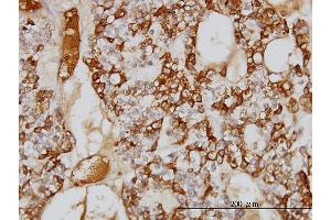 Immunostaining (ISt) image for anti-serpin Peptidase Inhibitor, Clade A (Alpha-1 Antiproteinase, Antitrypsin), Member 3 (SERPINA3) (AA 25-423) antibody (ABIN559731)