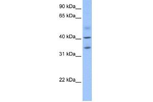 WB Suggested Anti-ZC3H14 Antibody Titration: 0. (ZC3H14 抗体  (N-Term))