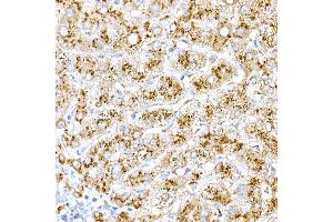 Immunohistochemistry of paraffin-embedded rat brain using Cathepsin D Rabbit pAb (ABIN6127553, ABIN6139223, ABIN6139224 and ABIN6217233) at dilution of 1:100 (40x lens).