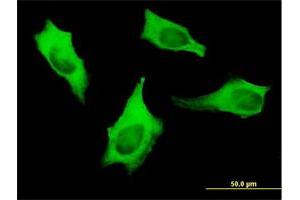 Immunofluorescence of monoclonal antibody to MYH9 on HeLa cell. (Myosin 9 抗体  (AA 131-220))