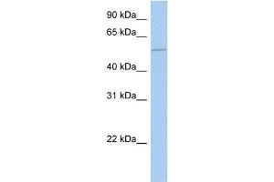 WB Suggested Anti-ALG1 Antibody Titration:  0. (ALG1 抗体  (N-Term))