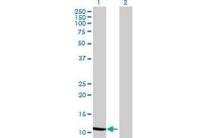 Western Blot analysis of WFDC5 expression in transfected 293T cell line by WFDC5 MaxPab polyclonal antibody. (WFDC5 抗体  (AA 1-123))