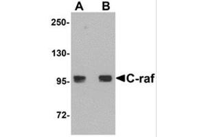 Western Blotting (WB) image for anti-V-Raf-1 Murine Leukemia Viral Oncogene Homolog 1 (RAF1) (N-Term) antibody (ABIN781705) (RAF1 抗体  (N-Term))