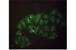 Stainning of methanol-fixed Hela cells: Mouse anti-Human beta 2 Microglobulin monoclonal antibody (D2A10) 1/50 (20 µg/ml). (beta-2 Microglobulin 抗体)