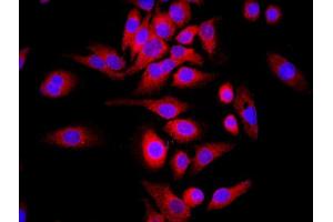 MCF-7 cells were stained with WDR26 Polyclonal Antibody, Unconjugated at 1:500 in PBS and incubated for two hours at 37°C followed by Goat Anti-Rabbit IgG (H+L) Cy3 conjugated secondary antibody. (WDR26 抗体  (AA 101-200))