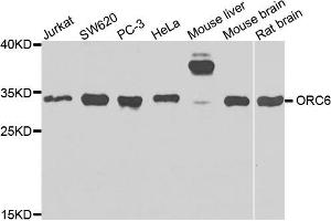 Western blot analysis of extracts of various cells, using ORC6 antibody. (ORC6 抗体)