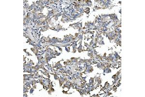 IHC analysis of NDP52/CALCOCO2 using anti-NDP52/CALCOCO2 antibody (ABIN7599401).