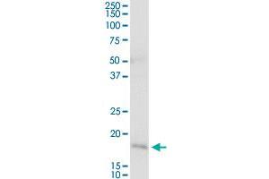 NNT MaxPab rabbit polyclonal antibody. (NNT 抗体  (AA 1-207))