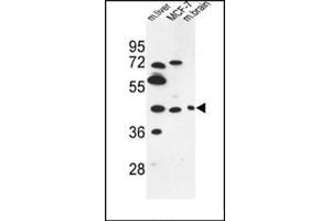Western blot analysis of PSG3 Antibody (N-term) in MCF-7 cell line and Mouse liver, brain tissue lysates (35ug/lane). (PSG3 抗体  (N-Term))
